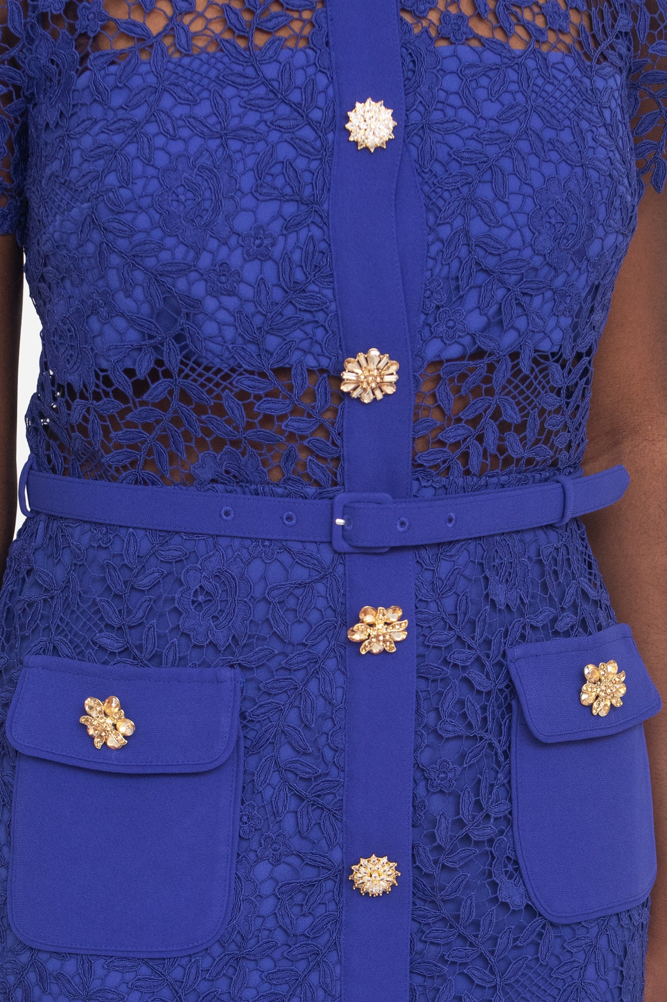 Blue Rose Lace Button Dress